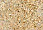 PI3K p55 gamma Antibody in Immunohistochemistry (Paraffin) (IHC (P))