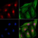 ING4 Antibody in Immunocytochemistry (ICC/IF)