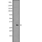 ING4 Antibody in Western Blot (WB)