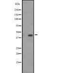 ACTA1/ACTA2/ACTC1 Antibody in Western Blot (WB)