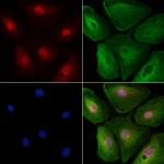 MLCK Antibody in Immunocytochemistry (ICC/IF)