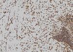 Beclin 2 Antibody in Immunohistochemistry (Paraffin) (IHC (P))