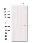 NPBWR1 Antibody in Western Blot (WB)