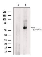 OR1J1 Antibody in Western Blot (WB)