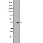 OR1J4 Antibody in Western Blot (WB)