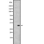 RGR Antibody in Western Blot (WB)