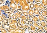 ALAS1 Antibody in Immunohistochemistry (Paraffin) (IHC (P))