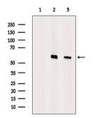 ALAS1 Antibody in Western Blot (WB)