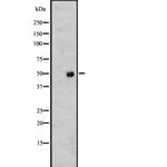 TUBA4A Antibody in Western Blot (WB)