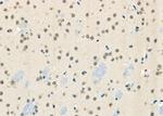 BRD4 Antibody in Immunohistochemistry (Paraffin) (IHC (P))