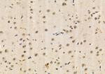 BRD4 Antibody in Immunohistochemistry (Paraffin) (IHC (P))