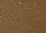 H2AK9ac Antibody in Immunohistochemistry (Paraffin) (IHC (P))