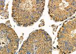 KDEL Receptor Pan Antibody in Immunohistochemistry (Paraffin) (IHC (P))