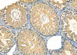 KDEL Receptor Pan Antibody in Immunohistochemistry (Paraffin) (IHC (P))