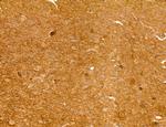 LRP1 Antibody in Immunohistochemistry (Paraffin) (IHC (P))