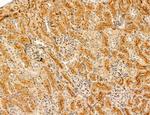 LRP1 Antibody in Immunohistochemistry (Paraffin) (IHC (P))