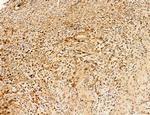 LRP1 Antibody in Immunohistochemistry (Paraffin) (IHC (P))