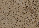 Myb Antibody in Immunohistochemistry (Paraffin) (IHC (P))