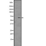 Phospho-PAK1/2/3 (Ser144, Ser141, Ser139) Antibody in Western Blot (WB)