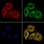 PMEL Antibody in Immunocytochemistry (ICC/IF)