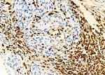 PTBP2 Antibody in Immunohistochemistry (Paraffin) (IHC (P))