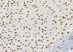 PTBP2 Antibody in Immunohistochemistry (Paraffin) (IHC (P))