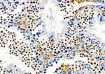 PTBP2 Antibody in Immunohistochemistry (Paraffin) (IHC (P))