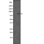 Phospho-DNM1L (Ser616) Antibody in Western Blot (WB)