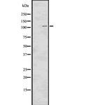 Phospho-EphA2 (Tyr772) Antibody in Western Blot (WB)