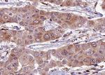 Phospho-DNM1L (Ser637) Antibody in Immunohistochemistry (Paraffin) (IHC (P))