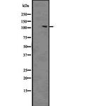 Phospho-ACK1 (Tyr859, Tyr860) Antibody in Western Blot (WB)