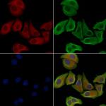 Phospho-IP3 Receptor 1 (Ser1756) Antibody in Immunocytochemistry (ICC/IF)