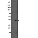 FOXE1 Antibody in Western Blot (WB)