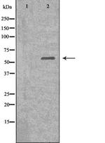 DKC1 Antibody in Western Blot (WB)