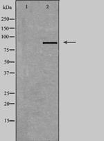 TACC1 Antibody in Western Blot (WB)