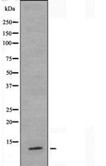 TUSC2 Antibody in Western Blot (WB)