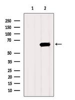 HEXB Antibody in Western Blot (WB)