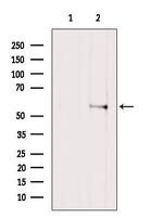 PFKFB1 Antibody in Western Blot (WB)