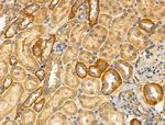 PFKL Antibody in Immunohistochemistry (Paraffin) (IHC (P))