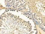 PFKL Antibody in Immunohistochemistry (Paraffin) (IHC (P))