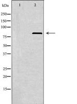 PFKL Antibody in Western Blot (WB)