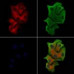 ITPKA Antibody in Immunocytochemistry (ICC/IF)