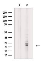 DTYMK Antibody in Western Blot (WB)