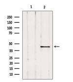 AKAP5 Antibody in Western Blot (WB)