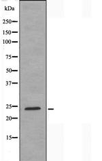 RPL10 Antibody in Western Blot (WB)