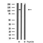 ITPKB Antibody in Western Blot (WB)