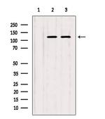 ITPKB Antibody in Western Blot (WB)