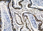 PRKAR1B Antibody in Immunohistochemistry (Paraffin) (IHC (P))