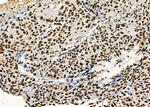 PRKAR1B Antibody in Immunohistochemistry (Paraffin) (IHC (P))