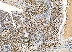 PRKAR1B Antibody in Immunohistochemistry (Paraffin) (IHC (P))